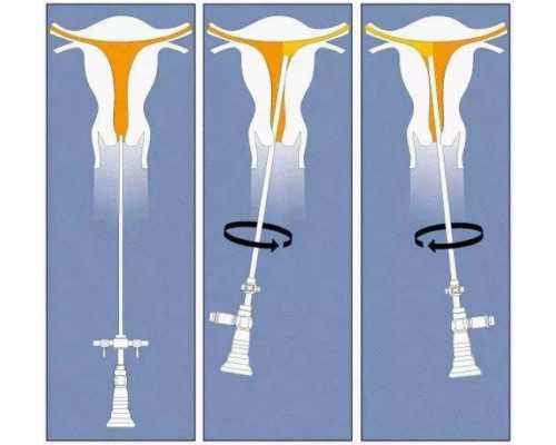 成都提供试管代孕 成都西囡医院试管婴儿多少钱 ‘胎儿做四维生长指标能判断