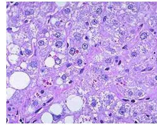 山东省排名前十名的试管医院 山东济南供卵试管所需证件 ‘怀孕54天什么症状