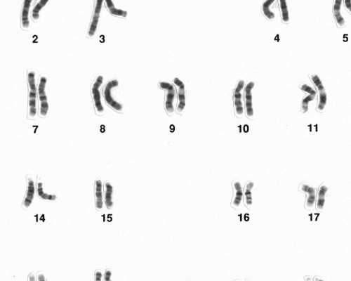 深圳试管代孕步骤电话 在深圳做试管婴儿花费明细一般是多少 ‘胎囊看男女什