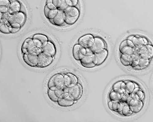 重庆高龄供卵试管包生男孩 重庆妇幼七星岗试管做试管婴儿要知道哪些常识？