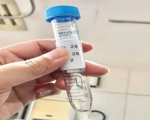 怎么预防产褥期抑郁症多关心爱护女性