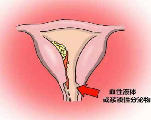 深圳供卵试管婴儿医院有哪些？,深圳供卵试管婴儿单周费用明细一览，2024借卵