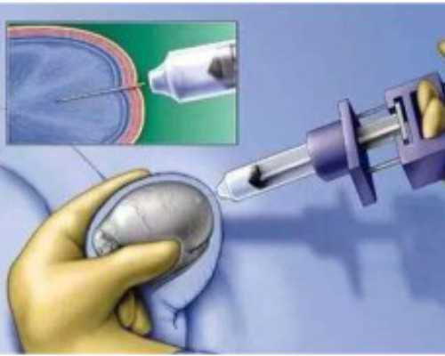 沈阳在供卵试管产子 沈阳菁华做试管怎么样？方方面面有保障 ‘b超单看男女准