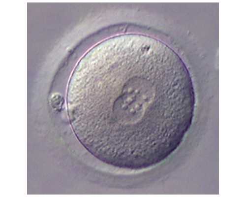 深圳助孕价格,深圳代生男孩,深圳代生妈妈,什么是三代试管婴儿技术？哪些医院