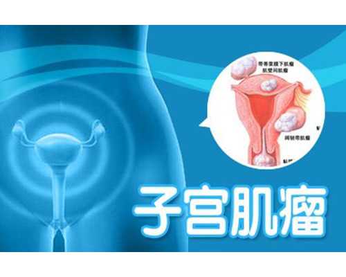 手抄报怎么做才简单又好看？