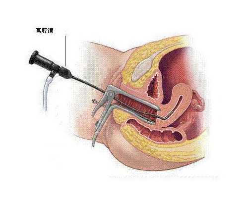 孕期需要每天洗外阴吗