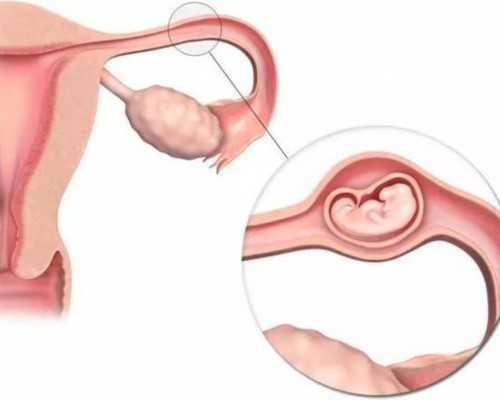 月经期总拉肚子是什么原因