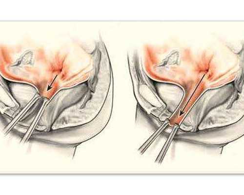 abo溶血检查结果怎么看