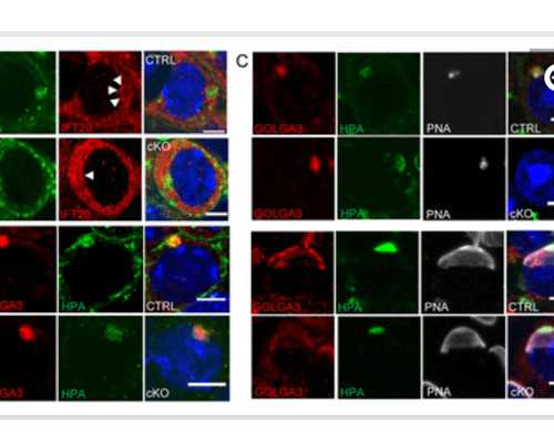 重庆三代试管婴儿预约 2023重庆试管婴儿包生男孩医院排名，附重庆三代试管生
