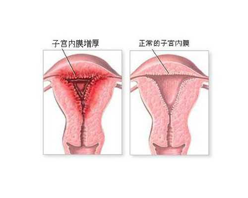 子宫肌瘤 大连医生 大连南关岭试管婴儿医院：做试管婴儿要做好这些工作 ‘男