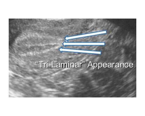重庆试管代怀男宝 2023重庆最顶尖的试管医院排名汇总，内附医院地址及最新试