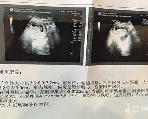 在绵阳做试管婴儿，费用大概是多少？这是详尽的试管流程