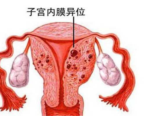 广州供卵被骗后尝试的解决办法,广州第三代试管费用：供卵试管一个要多少钱