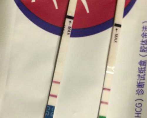 成都西囡医院试管技术怎么样？可以做第三代试管吗？